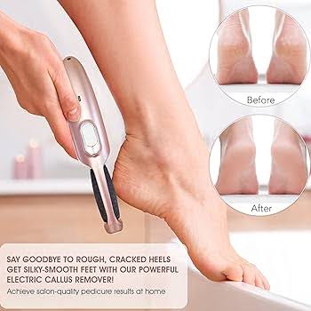 Rechargeable Electric Foot File Callus Remover for smooth soft feet