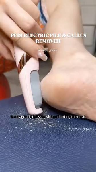 Rechargeable Electric Foot File Callus Remover for smooth soft feet